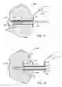 Fig. 14 - Devices and methods for performing procedures on a breast