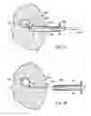 Fig. 25 - Devices and methods for performing procedures on a breast