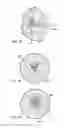 Fig. 26 - Devices and methods for performing procedures on a breast