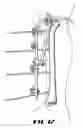 Fig. 10 - External fixation system