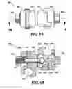 Fig. 13 - External fixation system