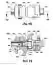 Fig. 15 - External fixation system