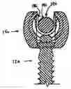 Fig. 01 - Polyaxial pedicle screw having a rotating locking element