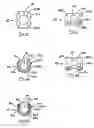 Fig. 06 - Polyaxial pedicle screw having a rotating locking element