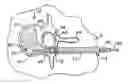 Fig. 01 - Systems and methods for treating fractured or diseased bone using expandable bodies