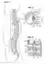 Fig. 02 - Systems and methods for treating fractured or diseased bone using expandable bodies