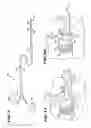 Fig. 03 - Systems and methods for treating fractured or diseased bone using expandable bodies