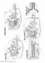 Fig. 06 - Systems and methods for treating fractured or diseased bone using expandable bodies