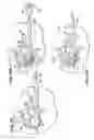 Fig. 07 - Systems and methods for treating fractured or diseased bone using expandable bodies