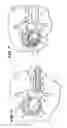 Fig. 09 - Systems and methods for treating fractured or diseased bone using expandable bodies