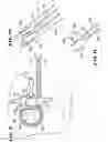 Fig. 11 - Systems and methods for treating fractured or diseased bone using expandable bodies