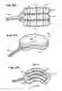Fig. 16 - Systems and methods for treating fractured or diseased bone using expandable bodies