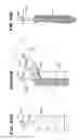 Fig. 29 - Systems and methods for treating fractured or diseased bone using expandable bodies