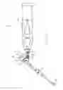 Fig. 08 - Surgical drill guide