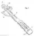 Fig. 02 - Instrumentation for insertion of an inter-vertebral prosthesis