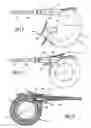 Fig. 02 - Gastric ring made of variable hardness elastomeric material