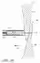 Fig. 09 - Patent foramen ovale closure system