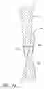 Fig. 10 - Patent foramen ovale closure system