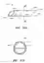 Fig. 34 - Patent foramen ovale closure system