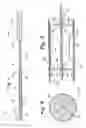 Fig. 02 - Vascular exclusion catheter