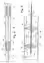 Fig. 03 - Vascular exclusion catheter