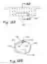 Fig. 10 - Vascular exclusion catheter