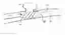 Fig. 01 - Aneurysm buttress arrangement