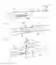 Fig. 02 - Aneurysm buttress arrangement