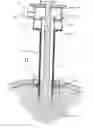 Fig. 01 - Expandible surgical access device