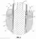 Fig. 09 - Expandible surgical access device