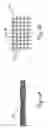 Fig. 02 - Method and device for filtering body fluid