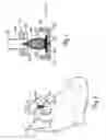 Fig. 09 - Method and device for filtering body fluid