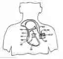 Fig. 01 - Subcutaneous cardiac rhythm management