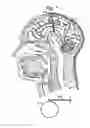 Fig. 02 - Method for treating a stroke by implanting a first therapy delivery element in the CNS and a second therapy delivery element in a damaged tissue of the CNS to promote neurogenesis