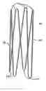 Fig. 01 - Endovascular support device and method