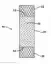Fig. 01 - Prosthesis graft with Z pleating