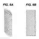 Fig. 06 - Prosthesis graft with Z pleating