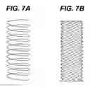 Fig. 07 - Prosthesis graft with Z pleating