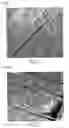 Fig. 02 - Hydroxyapatite composite and manufacturing method thereof, medical material using hydroxyapatite complex