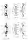 Fig. 07 - Accommodating intraocular lens system and method