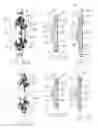 Fig. 08 - Accommodating intraocular lens system and method