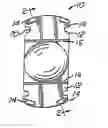 Fig. 01 - Intraocular lenses with fixated haptics