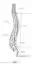 Fig. 02 - Prostheses, systems and methods for replacement of natural facet joints with artificial facet joint surfaces