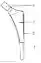 Fig. 01 - Body joint replacement titanium implant comprising one or several base bodies