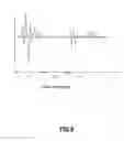 Fig. 06 - Digital signal processing apparatus, method thereof and headphone apparatus