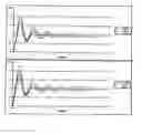 Fig. 01 - Method for monitoring a technical system