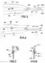 Fig. 04 - Contoured jaw extractor tool and method