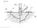 Fig. 09 - Plastic micro packer and construction method using it