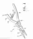 Fig. 02 - Hand tool having bendable holding portion