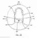 Fig. 02 - Altering the stiffness, size and/or shape of tissues for breathing disorders and other conditions